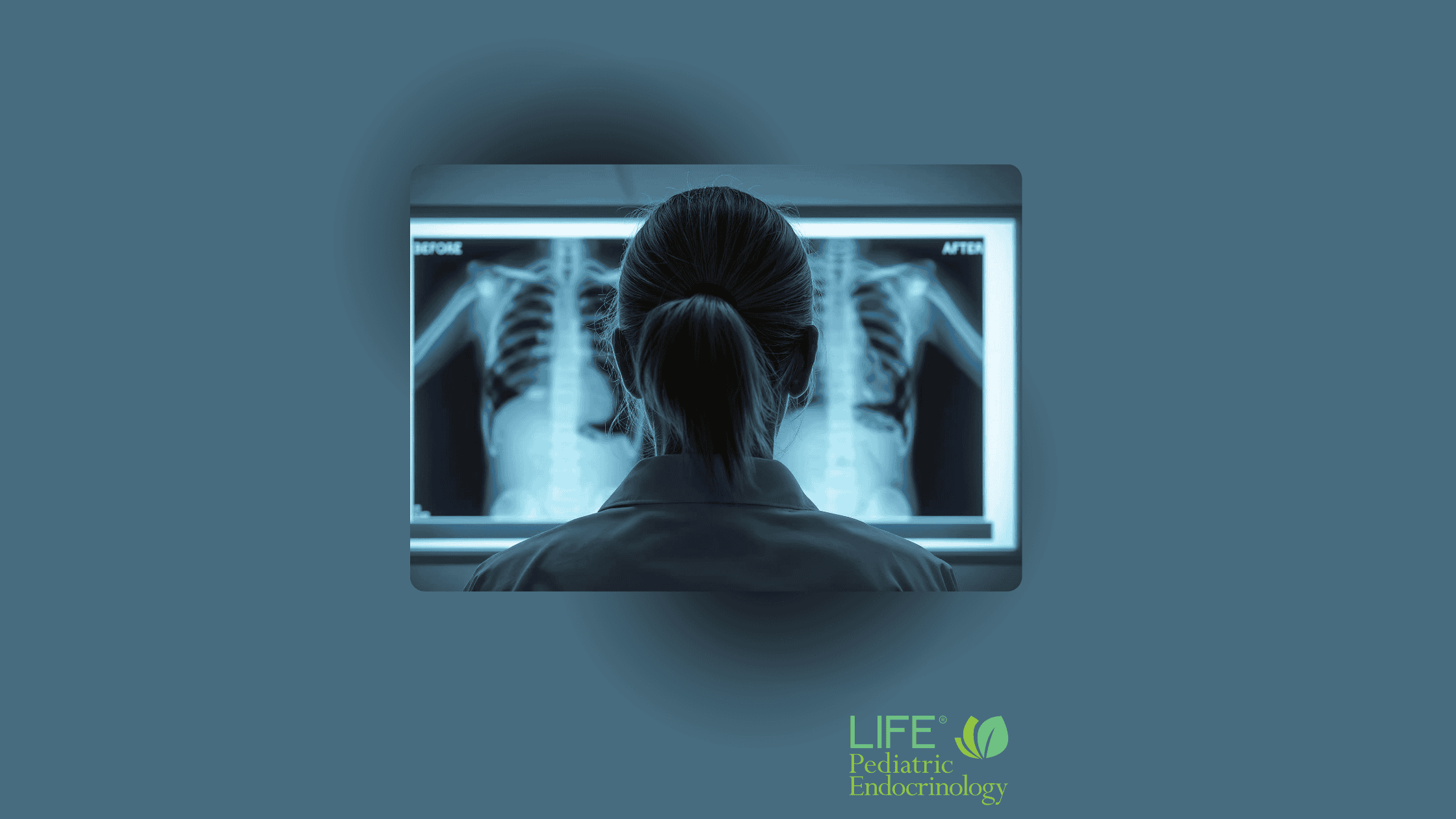 hypophosphatasia-hpp-asfotase-alfa-treatment-dr-kelli-davis-1